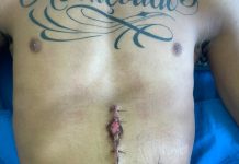 Jovem passa por cirurgia após suposta agressão de seguranças