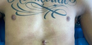 Jovem passa por cirurgia após suposta agressão de seguranças